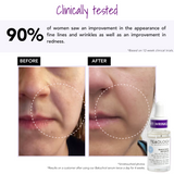 Bakuchiol Infusion Serum I Teaology Skincare